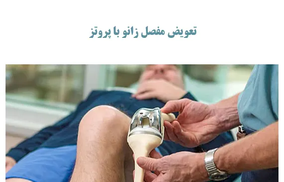 تعویض مفصل زانو با پروتز