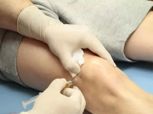 تزریق پی آر پی به زانو