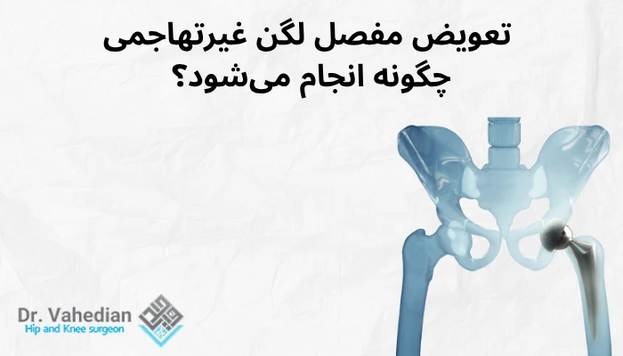 تعویض مفصل لگن غیرتهاجمی چگونه انجام میشود؟ تعویض مفصل لگن غیرتهاجمی چگونه انجام میشود؟