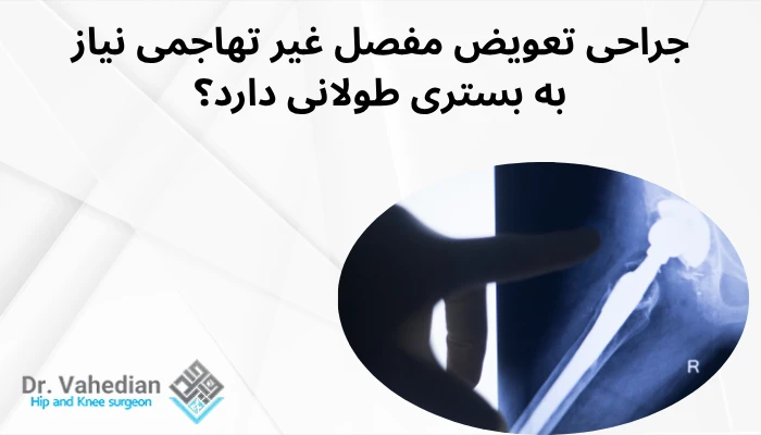 جراحی تعویض مفصل غیر تهاجمی نیاز به بستری طولانی دارد؟ جراحی تعویض مفصل غیر تهاجمی نیاز به بستری طولانی دارد؟