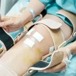 مراقبت بعد از تعویض مفصل زانو