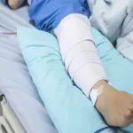 مراقبت بعد از عمل رباط صلیبی