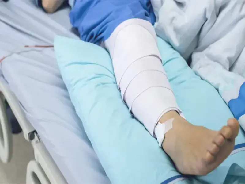 مراقبت بعد از عمل رباط صلیبی