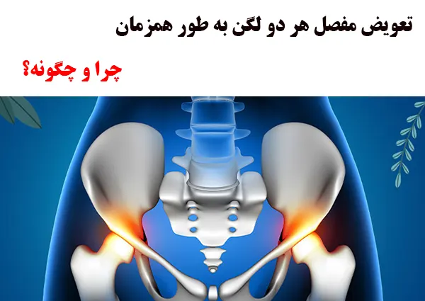 تعویض مفصل هر دو لگن 