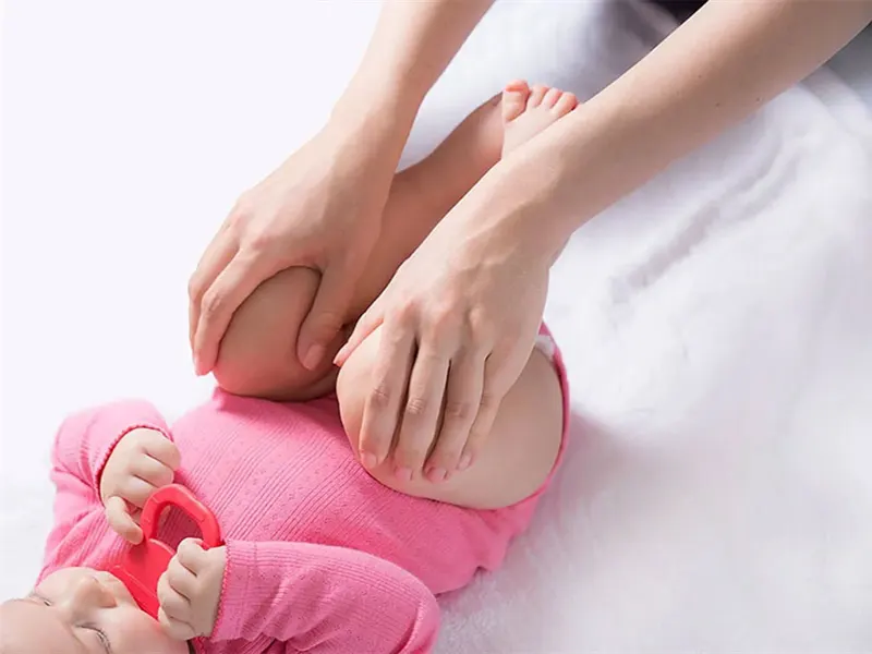دررفتگی مادرزادی لگن