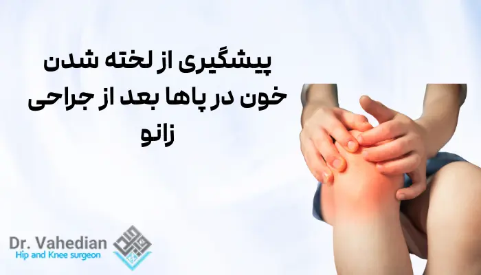 پیشگیری از لخته شدن خون در پاها بعد از جراحی زانو