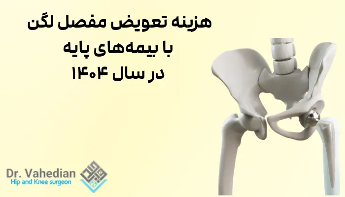 هزینه تعویض مفصل لگن با بیمههای پایه در سال 1404