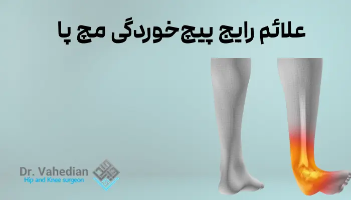 علائم رایج پیچخوردگی مچ پا