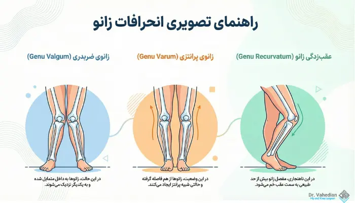 انواع انحراف زانو