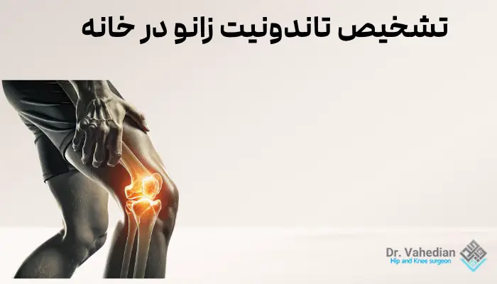 تشخیص تاندونیت زانو در خانه