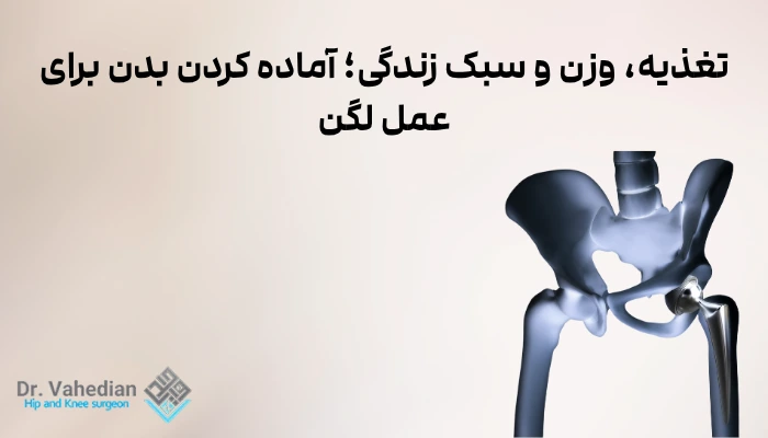 تغذیه، وزن و سبک زندگی؛ آماده کردن بدن برای عمل لگن