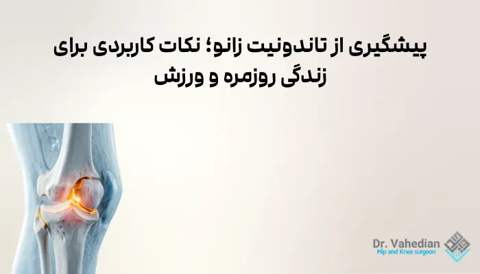 پیشگیری از تاندونیت زانو؛ نکات کاربردی برای زندگی روزمره و ورزش