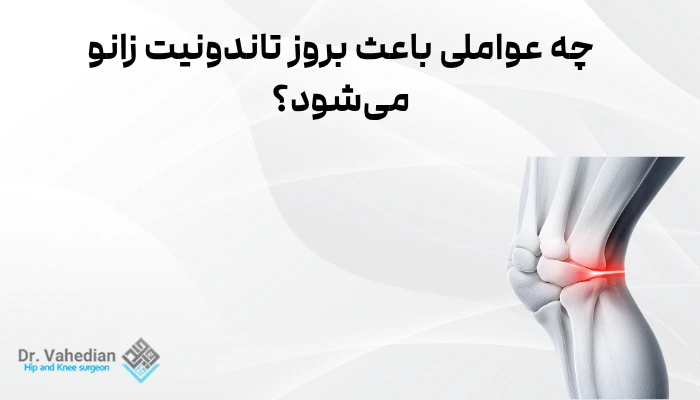 چه عواملی باعث بروز تاندونیت زانو میشود؟